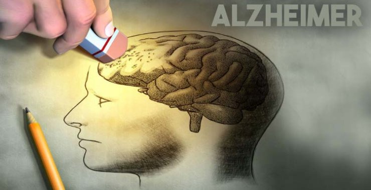 Realizarán las Segundas Jornadas de Alzheimer